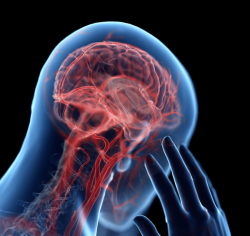 Comorbid Migraine, Insomnia Linked to Aberrant Locus Coeruleus Functional Connectivity