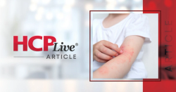 Phase 3 Data Indicate Roflumilast Cream Benefit Extend to Youngest Atopic Dermatitis Patients