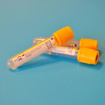 Preoperative Anemia Linked to Postoperative Delirium in New Study | Image Credit: Unsplash