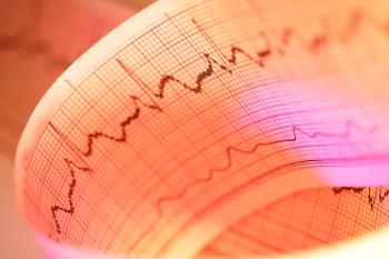 EKG strip displaying an arrhythmia