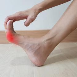 StudyGout and GCKR Gene Likely, Study Suggests