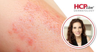 Pipeline News, Topical Steroids, and Views on PAs in Dermatology, With Cynthia Trickett, MPAS, PA-C