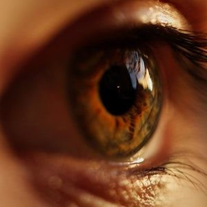 Multiple Genetic Variants Likely Underlie Early Onset Drusen Maculopathy