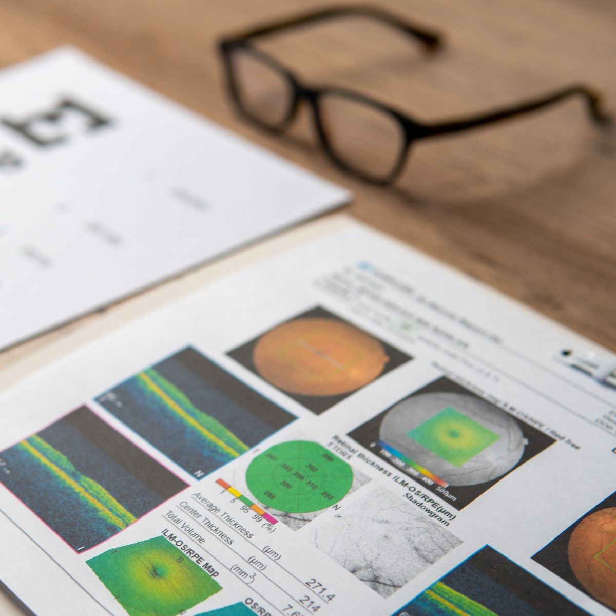 Weight-Adjusted Waist Index Successfully Predicts Macular Degeneration | Image Credit: Adobe Stock