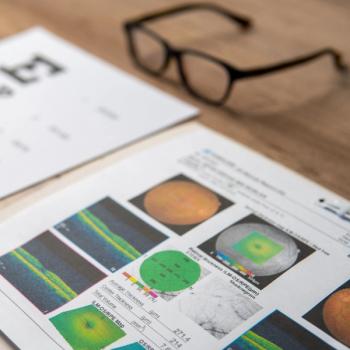 Weight-Adjusted Waist Index Successfully Predicts Macular Degeneration | Image Credit: Adobe Stock