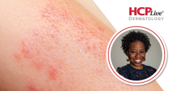 Cross Collaboration and Key Topics at SOCS Scientific Symposium, With Temitayo Ogunleye, MD