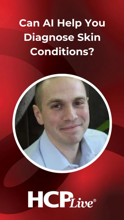 Can AI Help You Diagnose Skin Conditions?