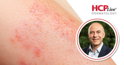 ADlong: Phase 3b Findings on Lebrikizumab in Atopic Dermatitis, With Stephan Weidinger, MD, PhD