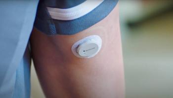 Dexcom glucose sensor