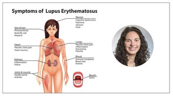 Lupus inequalities in health doctor-patient visit