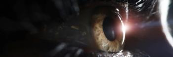 Teprotumumab Offers Hope for Thyroid Eye Disease Patients