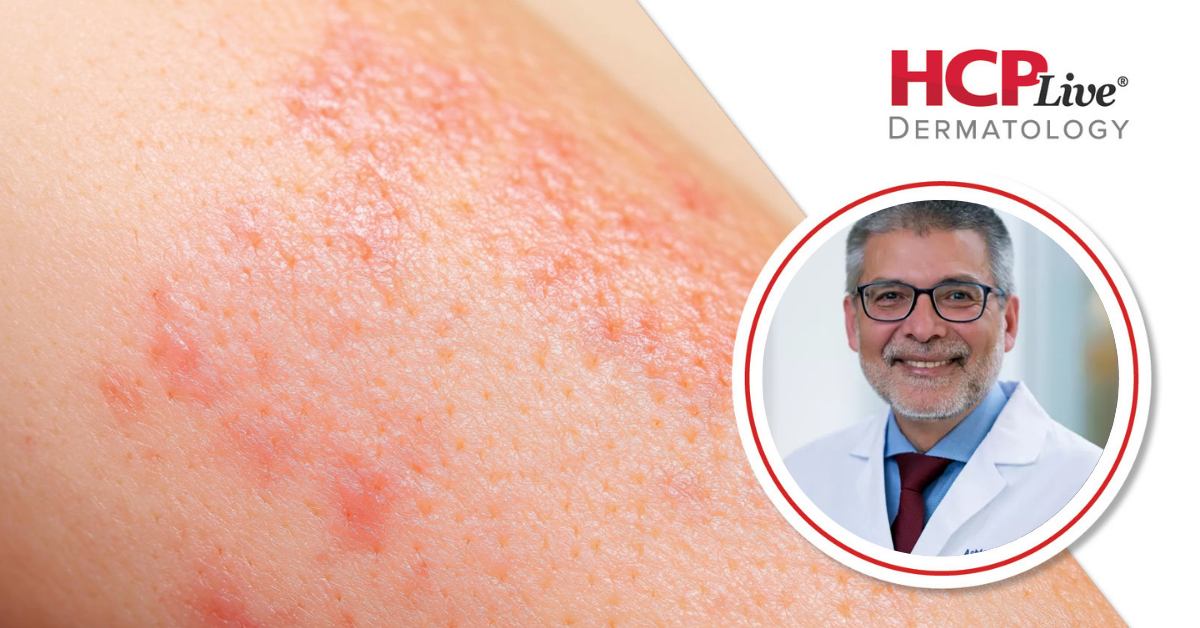 Tips on Dermoscopy and Skin Cancer Detection, With Ashfaq Marghoob, MD