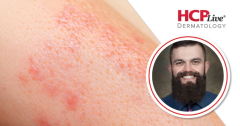 How Can Oils, Acupressure, and Supplements Improve Skin Conditions?