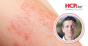 Next Steps for Upadacitinib in Non-Segmental Vitiligo, With Thierry Passeron, MD, PhD