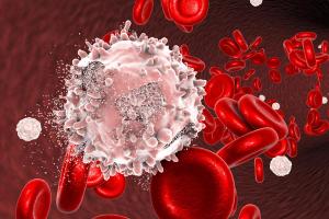 Venetoclax Approved for Older Patients With AML