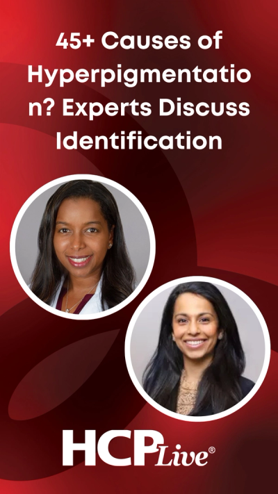 45+ Causes of Hyperpigmentation? Experts Discuss Identification
