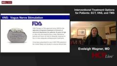 EP. 2 Interventional Treatment Options for Patients: ECT, VNS, and TMS