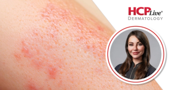 Off-Label JAK Inhibitors and New Drugs in the Dermatology Pipeline, With Gabriela Maloney, DO