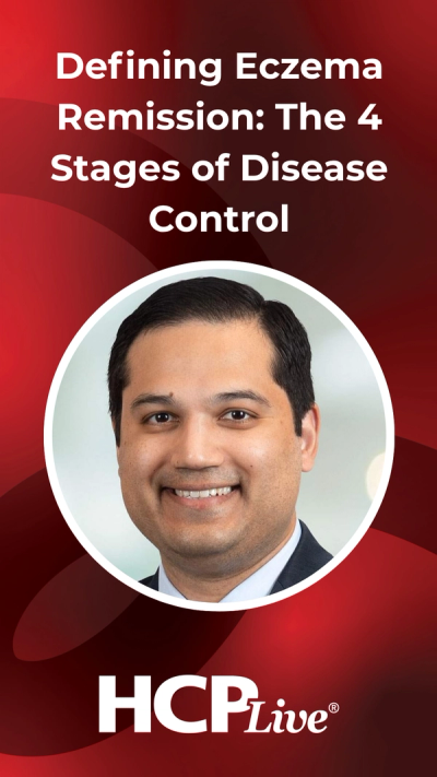 Defining Eczema Remission: The 4 Stages of Disease Control