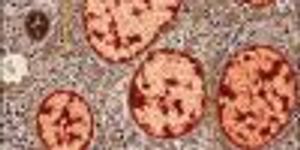 Researchers Discover New Method of Beta Cell Rejuvenation 