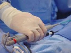 Colchicine Treatment Reduces Atrial Fibrillation Recurrence 