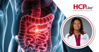 Colorectal Cancer Screening in 2026: Progress, Gaps, and What Comes Next, With Renee Williams, MD