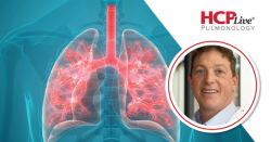 SUNRISE: Tezepelumab Shows Meaningful OCS Reduction in Severe Asthma, With Michael E. Wechsler, MD, MSc