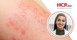 Discussing Challenges of Work in Dermatology Today, With Noreen Galaria, MD