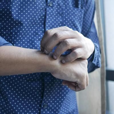 Evaluación de la dermatitis alérgica de contacto en pacientes remitidos para pruebas de parche. Evaluación de la dermatitis alérgica de contacto en pacientes remitidos para pruebas de parche.