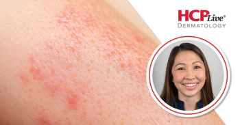 Highlighting 24-Week Findings on Povorcitinib for HS, With Martina Porter, MD