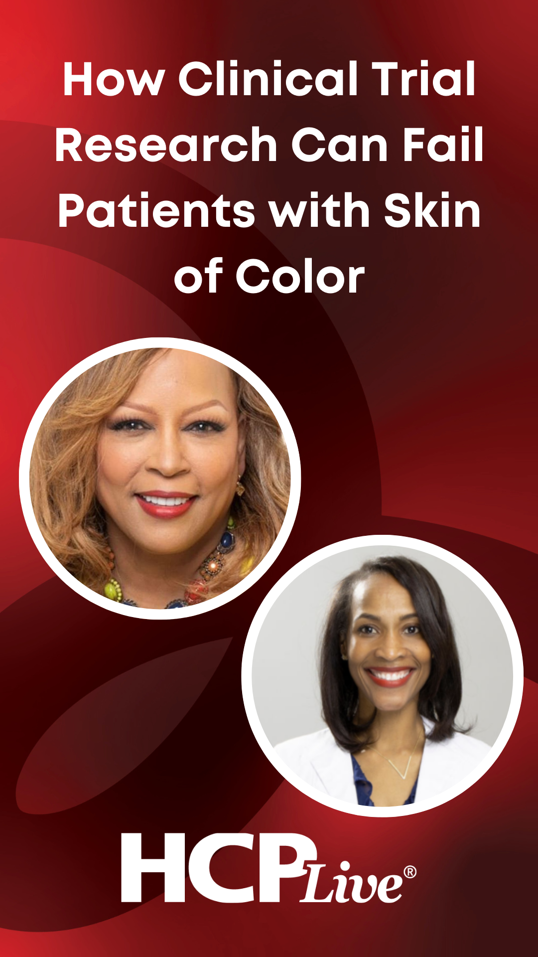 How Clinical Trial Research Can Fail Patients with Skin of Color | HCPLive