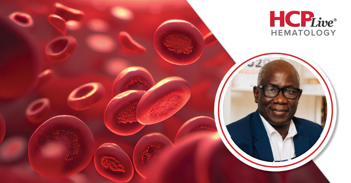 Addressing Global Care Gaps in Sickle Cell Disease, With Baba Inusa, MBBS