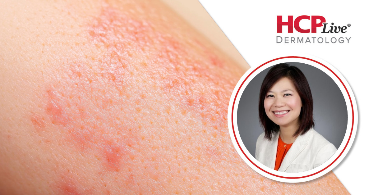 Ways to Improve Patient Experience with Surgery in Dermatology, With Michelle Nguyen, MD, MBA, MPH