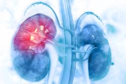Roxadustat Linked to Improved Iron Metabolism vs ESAs in Peritoneal Dialysis