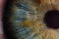 Glycemia-Associated Corneal Neurodegeneration May Begin Before Onset of T2D 