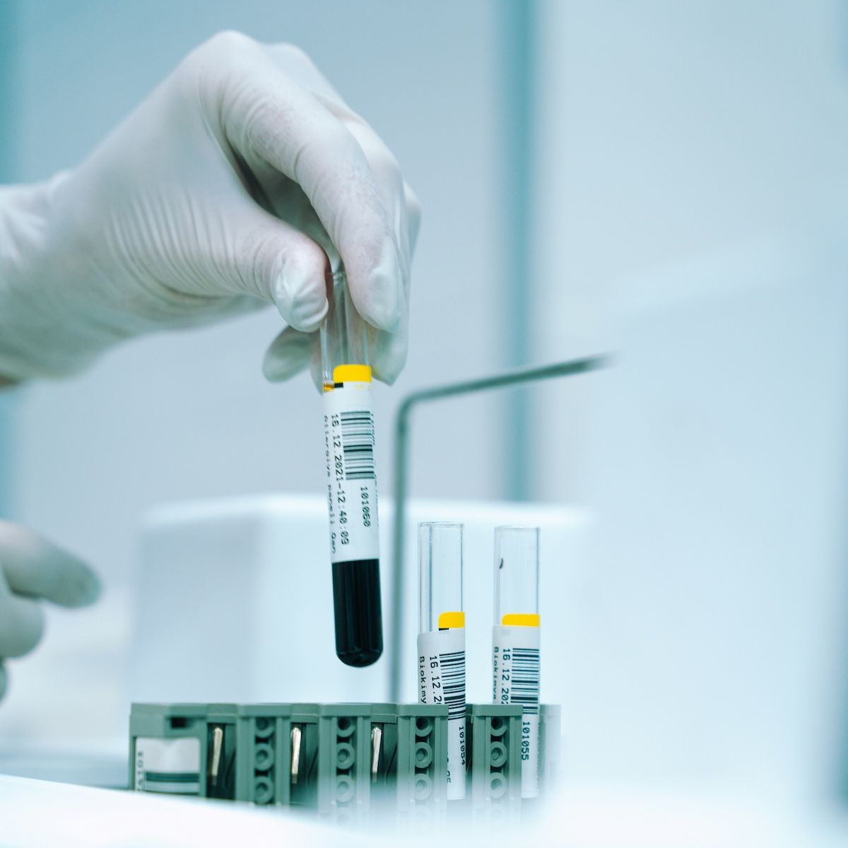 Voxelotor Retrospective Study Uncovers Additional Adverse Effects | Image Credit: Unsplash