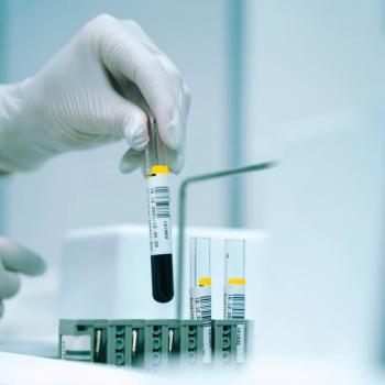 Voxelotor Retrospective Study Uncovers Additional Adverse Effects | Image Credit: Unsplash