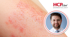 What Baseline Disease Severity Hides in PsA Trial Data, With David Oberlin, MD