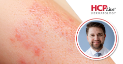 What Baseline Disease Severity Hides in PsA Trial Data, With David Oberlin, MD