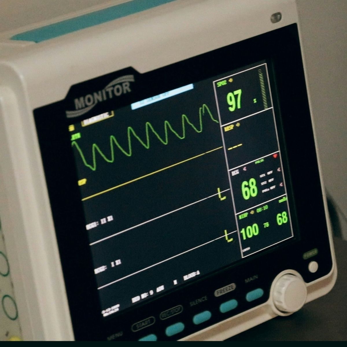 Early Rhythm Control Therapy for Atrial Fibrillation Unchanged by Diabetes, Obesity | Image Credit: Unsplash