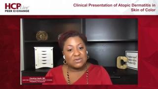 Diagnosing and Assessing AD in Patients With Skin of Color