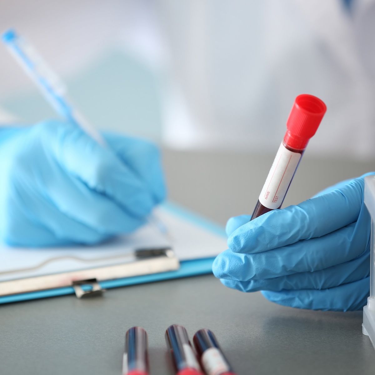 Anemia Exacerbates Adverse Effects of Hypertension and Blood Urea Nitrogen | Image Credit: Adobe Stock