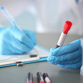 Anemia Exacerbates Adverse Effects of Hypertension and Blood Urea Nitrogen | Image Credit: Adobe Stock