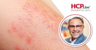 How to Deal With Cosmetic Complications in Dermatology, With Michael H. Gold, MD