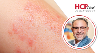 How to Deal With Cosmetic Complications in Dermatology, With Michael H. Gold, MD