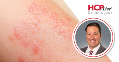 Key Off-Label Treatment Options in Dermatology, With Matthew Zirwas, MD