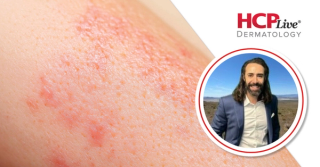 Positive Results Identified for Risankizumab and Other Psoriasis Drugs, With David Cotter, MD, PhD
