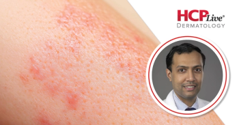 Q&A: How Dermatologists Can Utilize the AAD Clinical Image Collection, With Vinod Nambudiri, MD, MBA, MPH