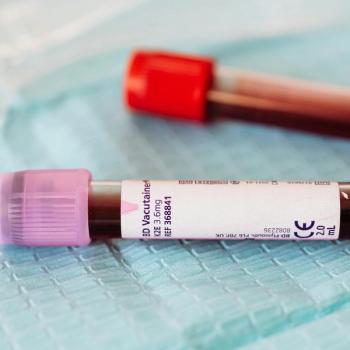Platelet-to-Neutrophil Ratio Associated with Predicting DME | Image Credit: Pexels