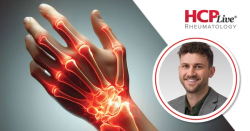 Polygenic Risk Scores Linked to Specific SLE Manifestations, With Matthew Dapas, PhD